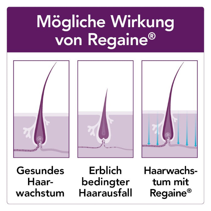 Regaine Frauen Lösung, 60 ml Lösung