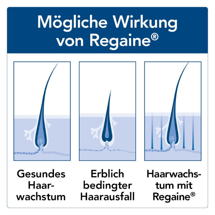 Regaine Männer Lösung, 60 ml Lösung